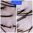 비타믹스 군산 | 군산 피부관리 / 두피,탈모관리 잘하는곳 - 올가드림뷰티 <수송점>