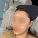 민메디케어 | 광주 스킨플래닝 멜로우왁싱 광주전대점 깐달걀 후기