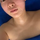플라즈마뷰티플러스업 | 창원 에스테틱 예담 볼뉴업 & 에스테틱기계 관리 후기 (플라즈마 + 수분케어)