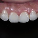 늘드림치과기공소 이미지