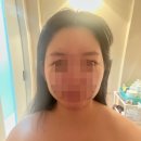 서울 얼굴경락 후기 작은 얼굴관리 10회 전 후 가격 고통 내돈내산
