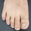 타임네일 페디베네 이미지