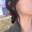 내돈내산 예쁨주의쁨의원 보톡스 후기