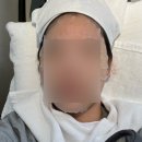 끌레르스킨케어 | 송파 잠실 피부관리 에스테틱ㅣ“끌레르 뷰티” 좁쌀여드름 압출 받고 피부결 달라진 후기