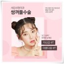 잘하는성형외과 네이버블로그