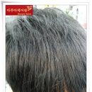 헤어팜 이미지
