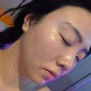 아이러브비타민 | 홍대 화이트태닝, 피부 재생도 된다는거 아세요? 아이러브탠 홍대점 5회 후기