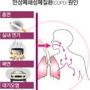 만성 이미지