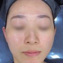루시아 에스테틱 - 김포시 | 김포 루시아 에스테틱 방문 후기 ! 단백질 물광케어로 피부 속부터 촉촉하게