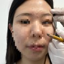 가산디자인 | 가산 얼굴형 맞춤디자인 눈썹 반영구 시술 후기