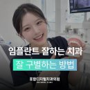 믿음치과기공소 | 임플란트잘하는포항치과 , 잘 구분하는 기준