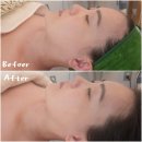 합성동311 | [경남 마산] 양덕동ㅣ합성동 피부 예신 관리 우아유 에스테틱 수기관리 내 돈 내산 다녀온 후기