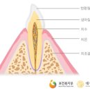 치아 변색의 원인 7가지, 미백치약 효과 있나? 이미지