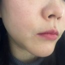 근본이화한의원 | 부산 해운대한의원 한방 다이어트 한약 찐후기: 출장 길에 만난 인생 터닝포인트
