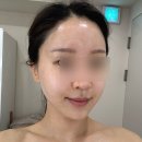 일라에스테틱 이미지