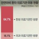 안면마비, 뇌질환 신호일수도 이미지