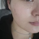 화봉 | 울산 북구 여드름 재생 관리 잘하는 올가드림뷰티 화봉점 솔직후기