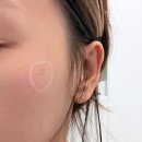 예젤의원 이미지