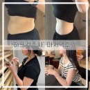 신사역 비만클리닉) 하프컷으로 여름 준비 완료! 팔뚝 복부 지방분해주사 마지막 후기