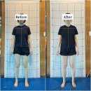 V therapy 안티에이징센터 | [송파재활] 뷔테라피 거북목·체형교정으로 통증 개선, 그 결과 나타난 안면비대칭 변화 (3년 기록)
