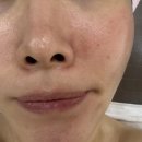 성미스킨케어