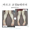 광주용선생짬뽕 | [광주/광산] 바르고 교정&테라피 슬림하체 관리 후기