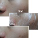 (주)오알파 | [이지함] 오알파 컨트롤 플러스 아크네 폼 클렌저