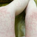 현대한증막 이미지