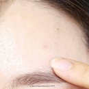 영플러스 | 올리브영 스팟 패치 1위 케어플러스 3종 트러블 흔적 패치 후기