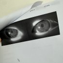 건양의료재단 김안과병원 | 영등포 김안과병원, 유아 안검내반 수술날짜 잡고 온 후기