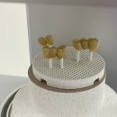 커스텀기공소 이미지