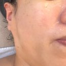 남양성지로 | [남양피부관리] 화성 남양읍 남양리 피부관리샵 수뷰티라인 솔직 후기!