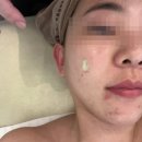 금손자연치유 | 라뷰숲칼프:)김포 피부관리 추천 / 장기동피부관리