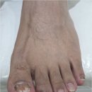 닥터아이티엔_로다살롱 | 대전 지족동 발톱무좀 꼼꼼하게 관리받은 열개의손가락 후기