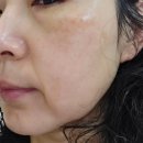 테이드 | 더마 스퀘어 판테이드 크림 리얼 후기