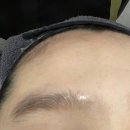 디톡스 | 전주 올가드림뷰티 금암점 :: 모공디톡스 후기