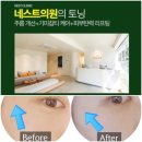 강남 피부과 추천｜여신티켓으로 &lt;네스트의원&gt; 기미잡티·레이저토닝 시작 후기 &amp; 관리 계획