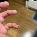 비전상상약국 | 셀로맥스 리페어크림] 애견동반 약국_내돈내산_내 손가락 상처 치료 후기_피부 재생 크림 추천_상처...