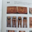 다이안 | 홍대 다이어트로 유명한 바디라인 개선 LPG 다이안테라피 다녀온 찐 후기