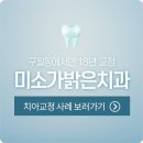밝은미소치과교정과치과의원 네이버블로그
