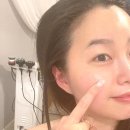 강릉피부관리 에스테틱 에이알에프(ARF)에서 윤곽관리 받고왔어요 주차 후기