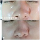 골드 휴 이미지