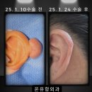 강남항외과의원 | 용인 수지 피지낭종 미세절개로 흉터를 최소화하세요!