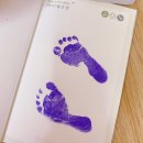 (주)씨에스냉장 | 인천 서구 “그린산부인과” 5박 6일 입원 생활 및 퇴원(제왕절개)