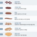 ‘둔감한 장 Vs 예민한 장’ 유산균도 장 맞춤형 이미지