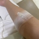 20대 첫 수면위내시경 후기. 추천 그리고 부작용.