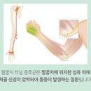 팔이 저려요 팔저림 원인 5가지 및 : 왼쪽 오른쪽 팔이 저린 이유 이미지