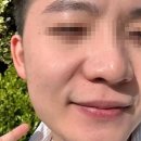 모공화장품