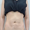 핑슬림의원 이미지