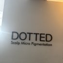 [강남/역삼] 나 왜 고민했니.. 여자M자탈모 두피문신 정수리문신 국내 아니 세계1위 다티드 강력추천!
